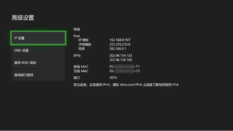 Xbox One VPN设置指南，解锁国际游戏乐趣，畅游全球游戏资源,xbox one设置vpn,第1张